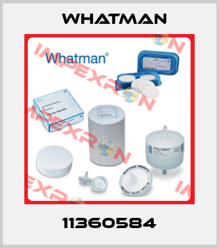 11360584 Whatman